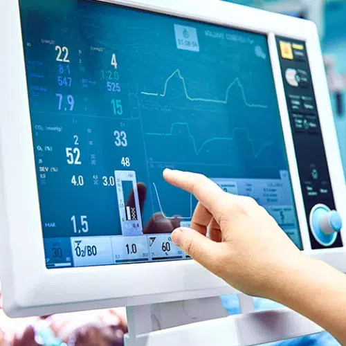 borderline ECG meaning