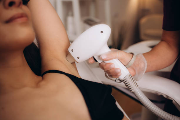 Can Laser Hair Removal Help with Ingrown Hairs