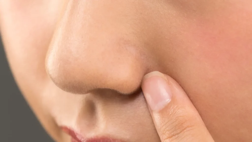 Discover the Best Rhinoplasty Surgeons Near You