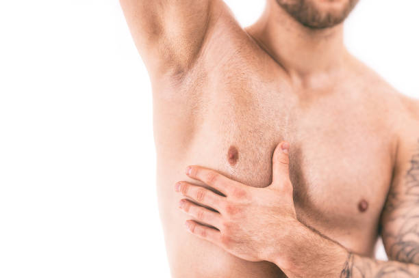 Does Gynecomastia Surgery Require General Anesthesia