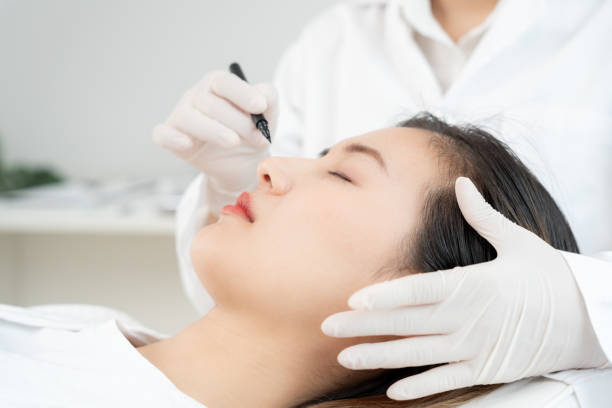 Does Rhinoplasty Boost Confidence