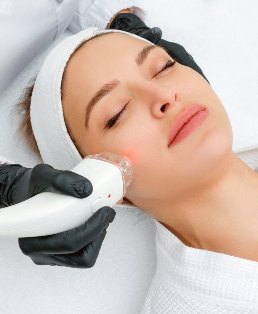 How Long Do Results from Facial Laser Treatment Last in Dubai’s Harsh Climate?