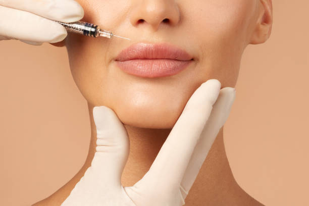 How Long Do Results of Lip Fillers Really Last