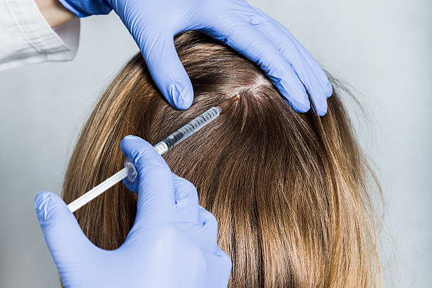 How PRP Treatment Restores Hair Growth Naturally