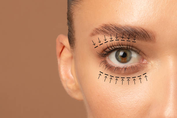 Is Eyelid Surgery Safe for Treating Droopy Eyelids