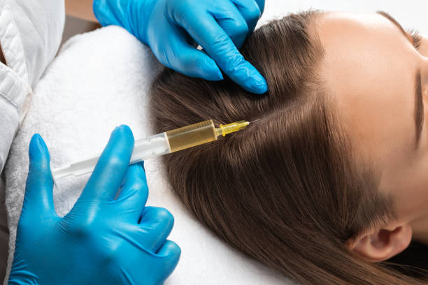 Is PRP Hair Treatment the Key to Regrowing Lost Hair