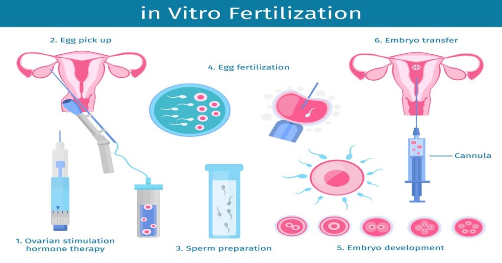 Why IVF Treatment in India Is a Top Choice for Couples Worldwide