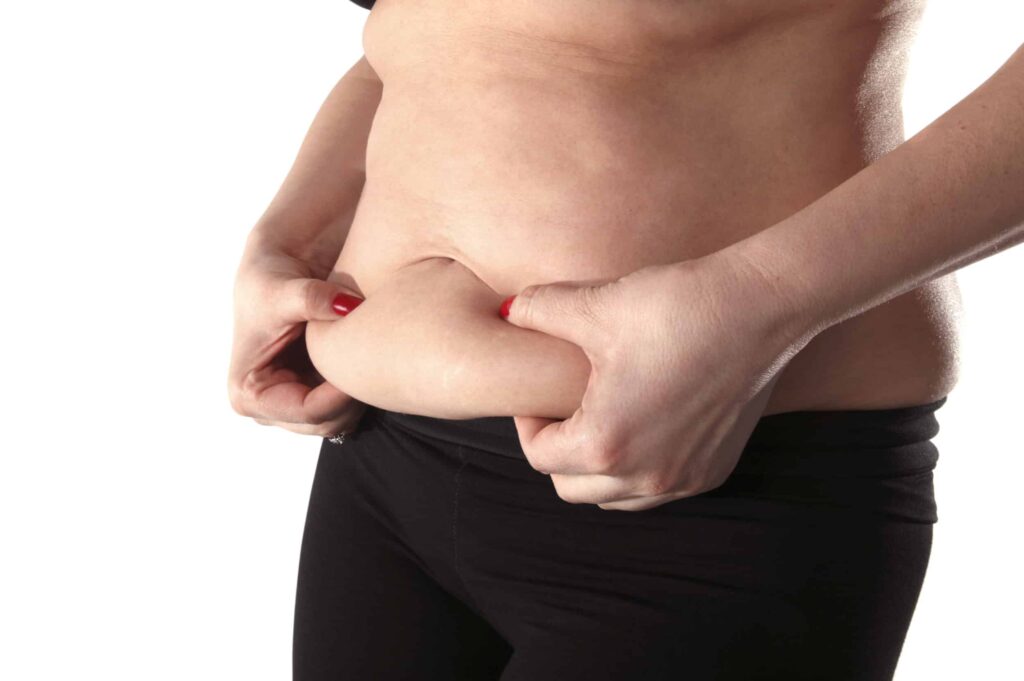 What Are the Benefits of Sculpsure Body Contouring Treatment?