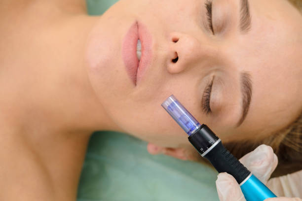 What Is Laser Mesotherapy Used For