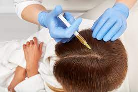 What Is PRP Hair Treatment and How Does It Work for Hair Growth?